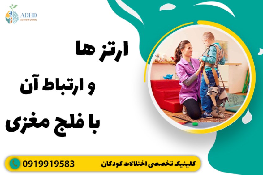 ارتز ها و ارتباط آن با فلج مغزی